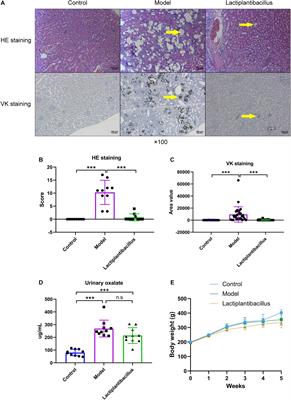 Lactiplantibacillus plantarum Reduced Renal Calcium Oxalate Stones by Regulating Arginine Metabolism in Gut Microbiota